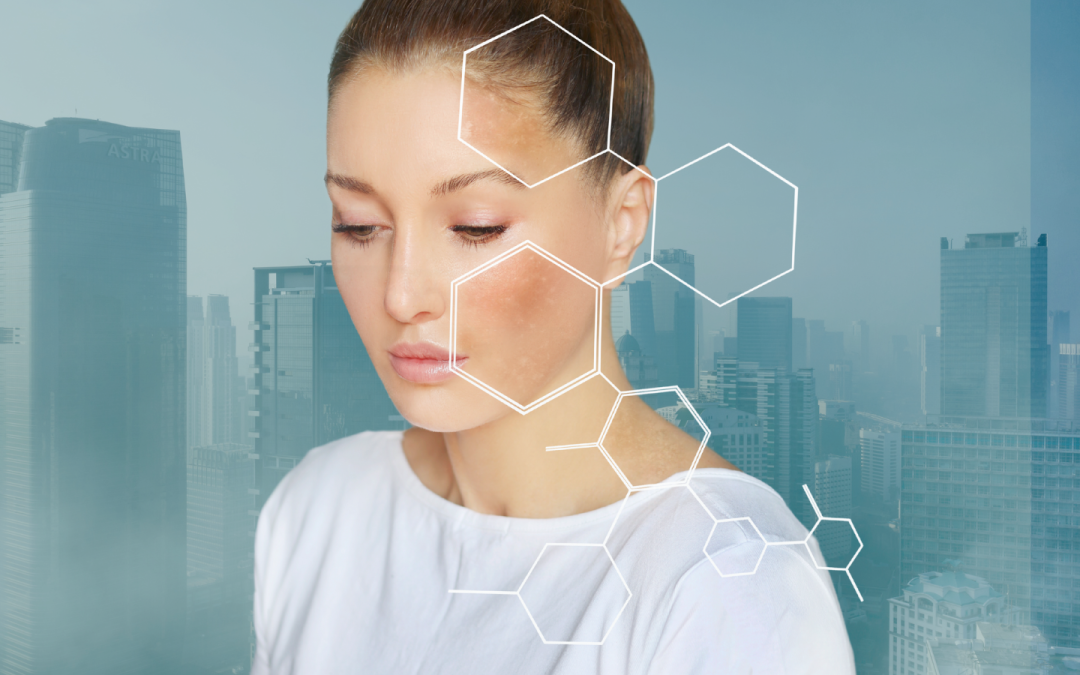 Formulating Skincare for Environmental Stressors