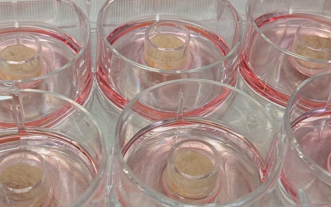 Ex Vivo Tissue Models in Dermatology Drug Development